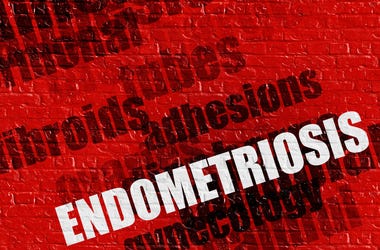 Endometriosis