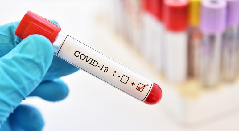 COVID-19 coronavirus