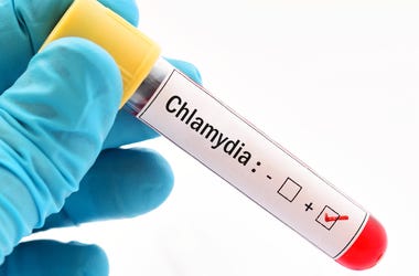 Chlamydia