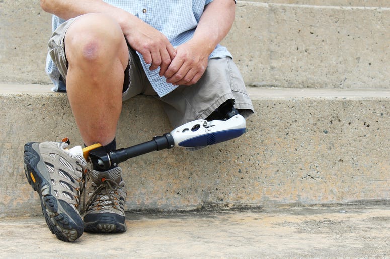 Prosthetic Leg