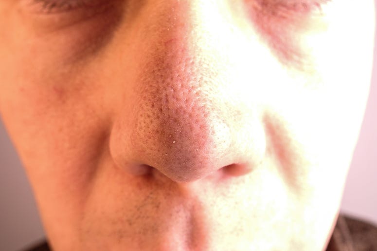 Nose Nose