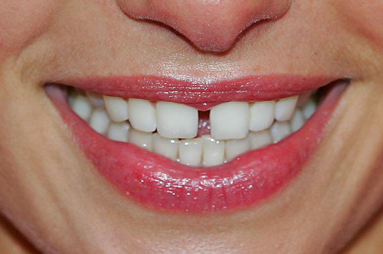 Teeth Teeth