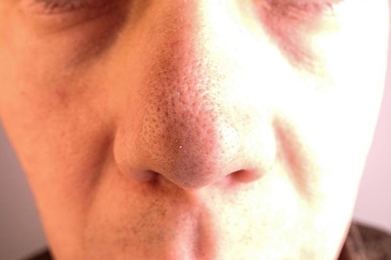 Nose Nose