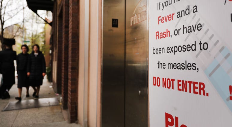 measles sign measles sign