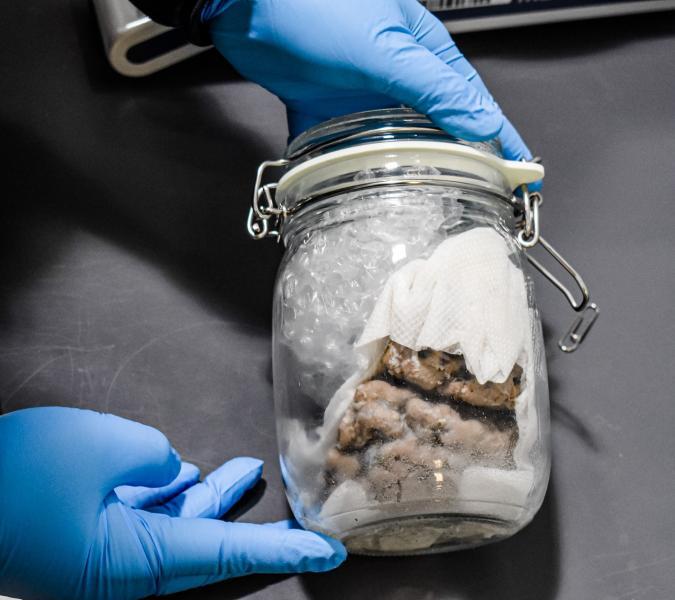 Human brain discovered in shipment. Human brain discovered in shipment.
