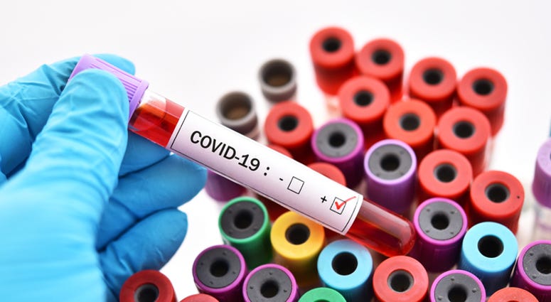 Coronavirus