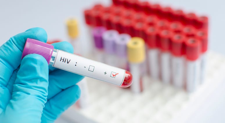 U.N.: COVID-19 pandemic hurting progress in fighting AIDS