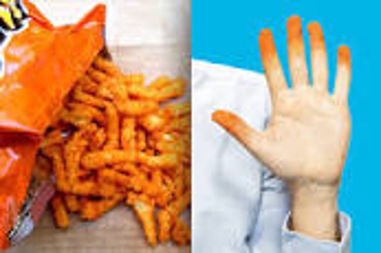 Cheetos Has name For Dusty Cheese Residue On Hands
