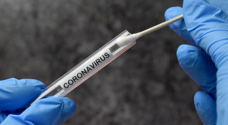 Coronavirus Test Tube - File Photo Coronavirus Test Tube - File Photo